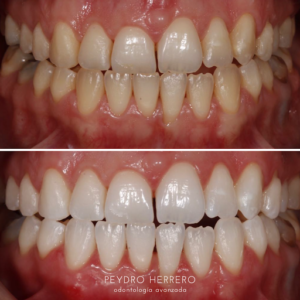 Clínica Dental Peydro Herrero