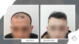 Centro Médico Estético en Valencia - Clínica Devesa