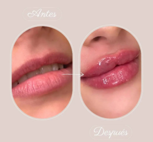 Luxe Clinica Medicina Estética y Micropigmentación en Valencia