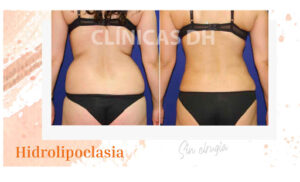Clínicas DH - C. de Dolores Marqués Medicina Estética y Depilación Láser