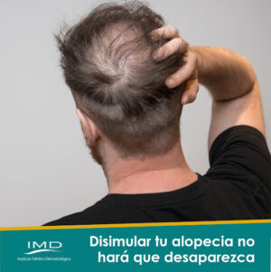 Clínica capilar IMD - Instituto Médico Dermatológico