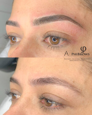 Micropigmentacion Capilar Valencia Thay