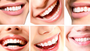 Clinica Dental Vendent. Implantes dentales.