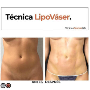 Clínica Doctor Life Cirugía, Estética y Obesidad Valencia